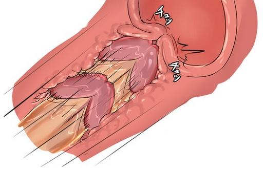 manga drawing of a high-speed penis knocking against a cervical opening