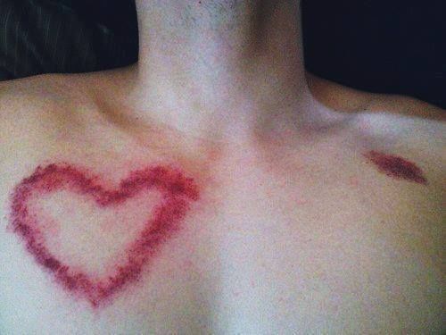 hicky in the shape of a heart ... awww!