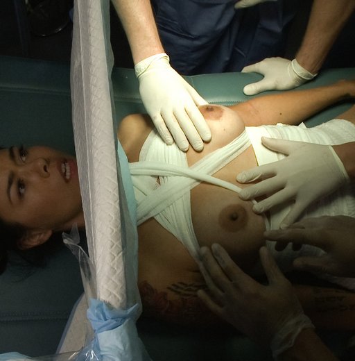 waking up from the anesthetic to find the surgeons playing with her boobs