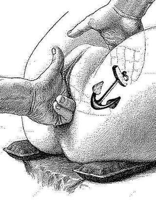 illustration of a manual pelvic exam, with anomalous anchor