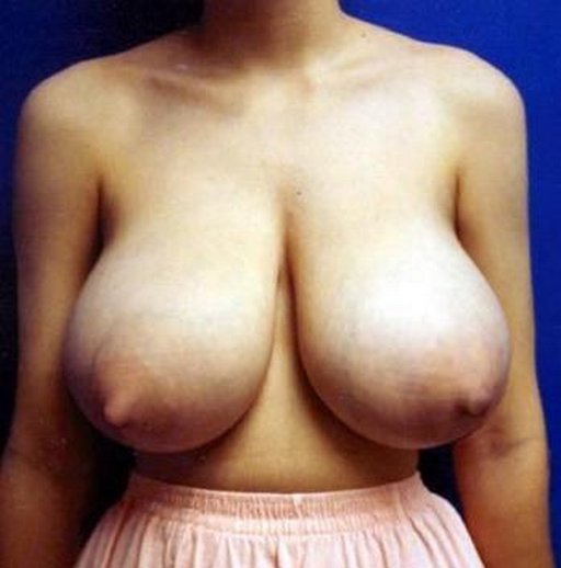 her-breasts