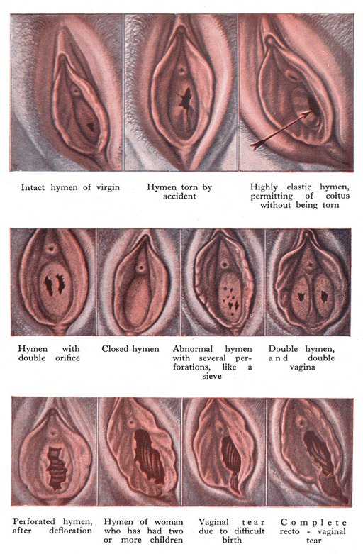 hymen taxonomy