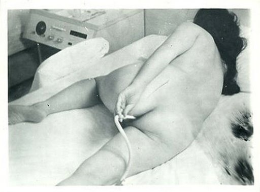 vintage enema photo